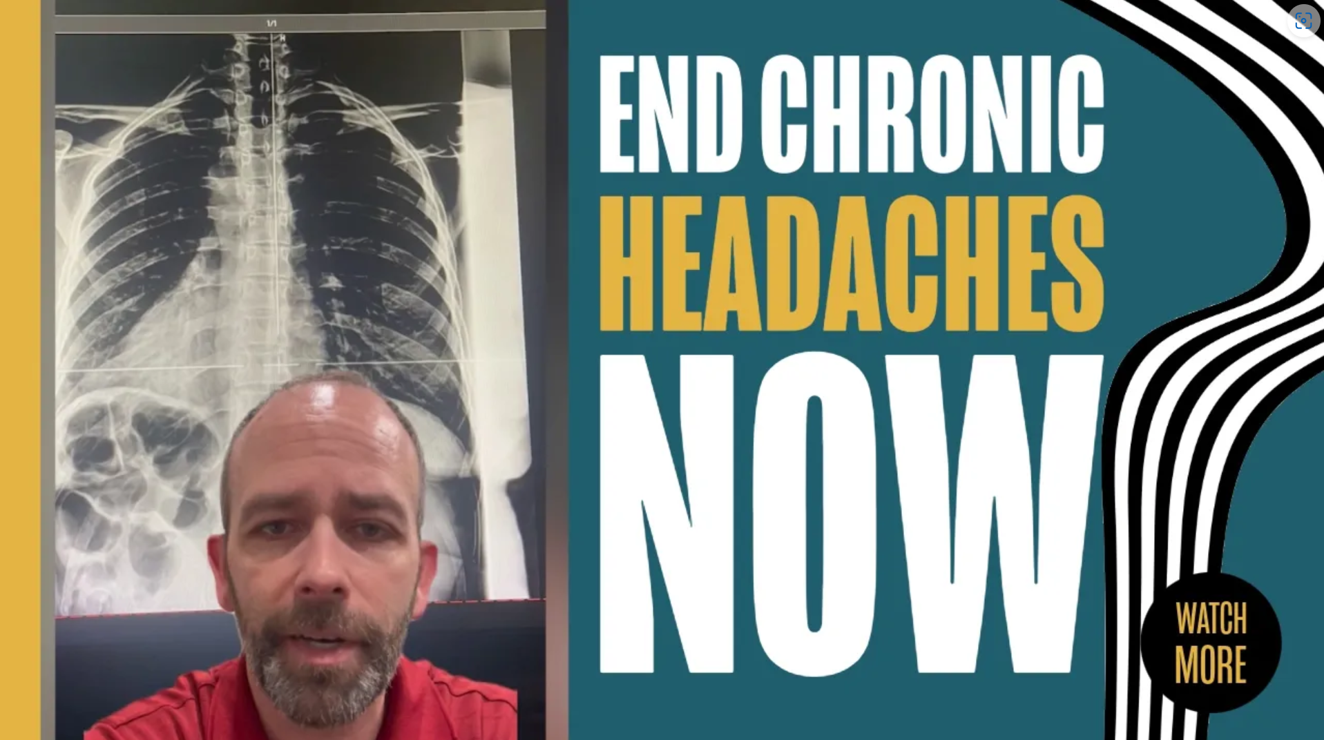 Stop Chronic Headaches Naturally | Chiropractor for Headaches in Rochester Hills, MI